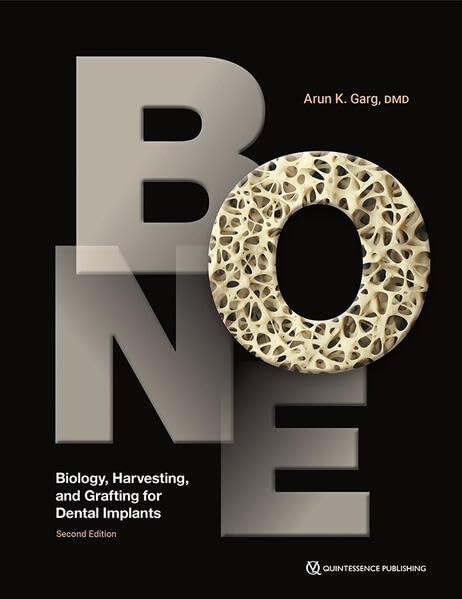 Bone: Biology, Harvesting, and Grafting for Dental Implants 2nd Edition