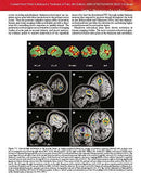 Wall & Melzack's Textbook of Pain: Expert Consult -  (Wall and Melzack's Textbook of Pain) 6th Edition