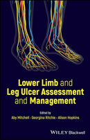 Lower Limb and Leg Ulcer Assessment and Management 1st Edition,
