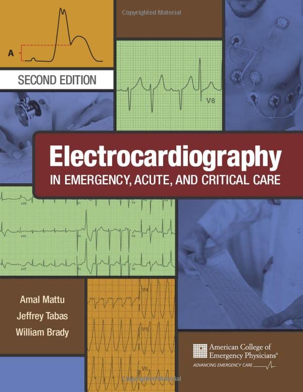 Electrocardiography in Emergency, Acute, and Critical Care