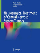 Neurosurgical Treatment of Central Nervous System Tumors 2024th Edition