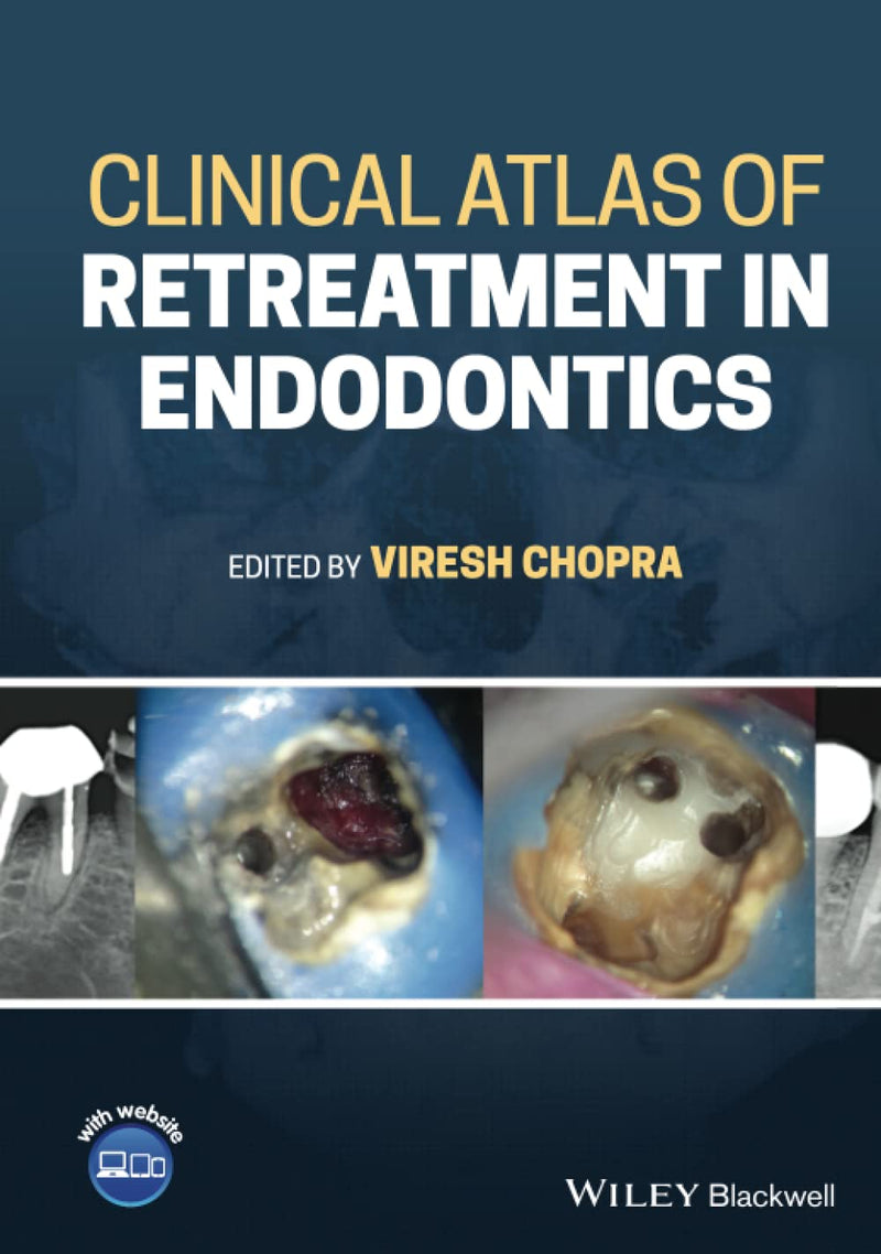 Clinical Atlas of Retreatment in Endodontics 1st Edition