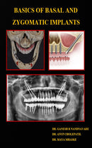 BASICS OF BASAL AND ZYGOMATIC IMPLANTS