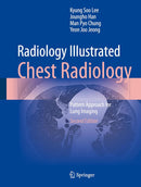 Radiology Illustrated: Chest Radiology: Pattern Approach for Lung Imaging