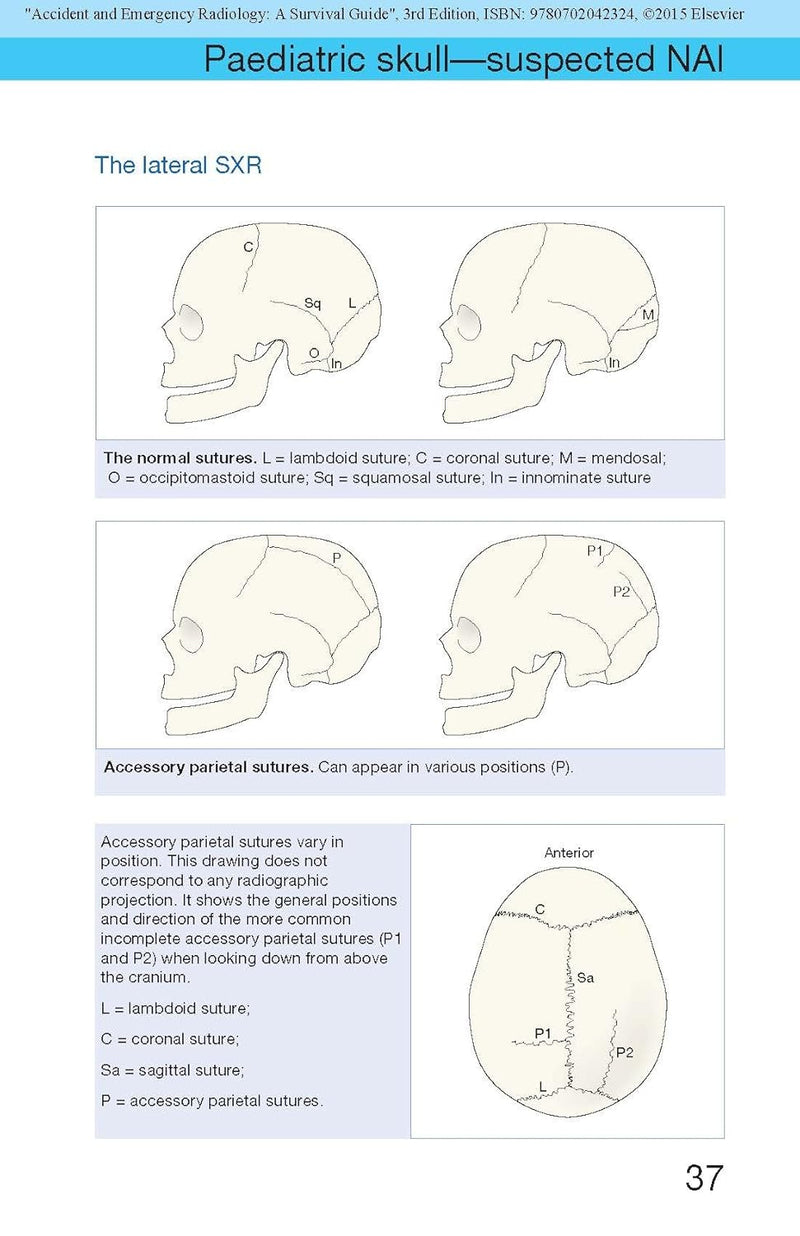 Accident and Emergency Radiology: A Survival Guide
