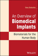 An Overview of Biomedical Implants: Biomaterials for the Human Body 1st Edition