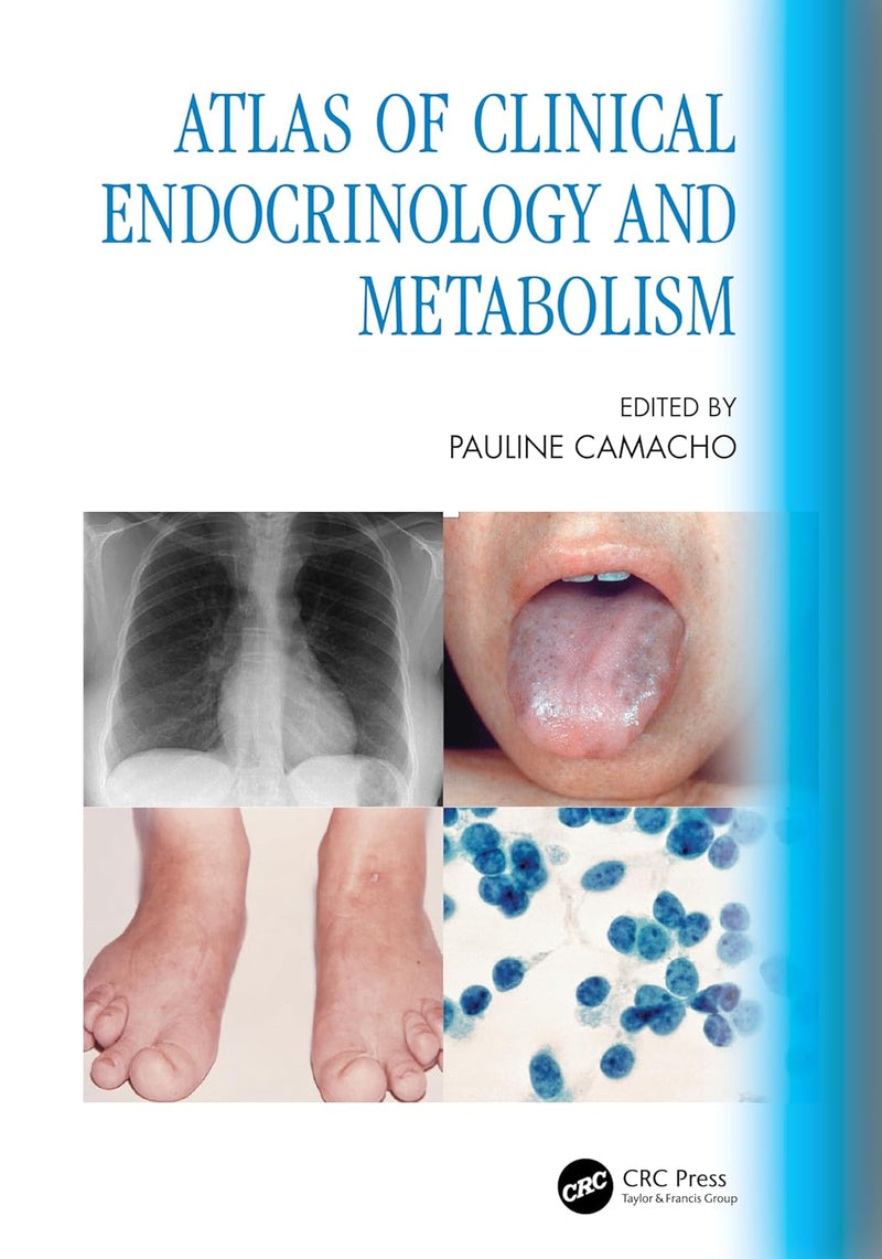 Atlas of Clinical Endocrinology and Metabolism 1st Edition