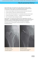 Accident and Emergency Radiology: A Survival Guide