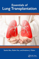Essentials of Lung Transplantation 1st Edition