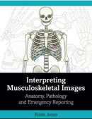 Interpreting Musculoskeletal Images: Anatomy, Pathology and Emergency Reporting