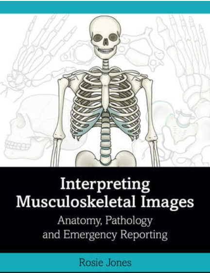 Interpreting Musculoskeletal Images: Anatomy, Pathology and Emergency Reporting