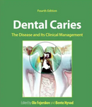 Dental Caries: The Disease and its Clinical Management, 4th Edition